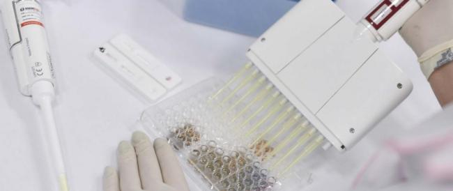 Coronavirus, 'antiparassitario lo uccide entro 48 ore in laboratorio'